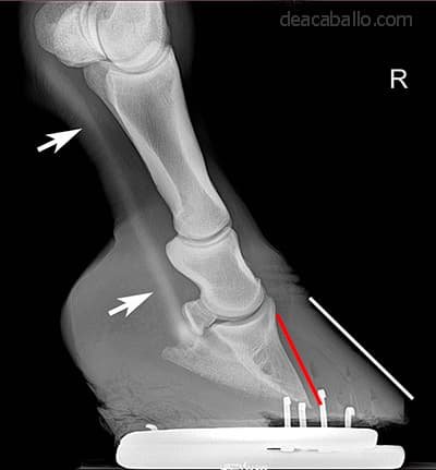 radlaminitis3a (1)